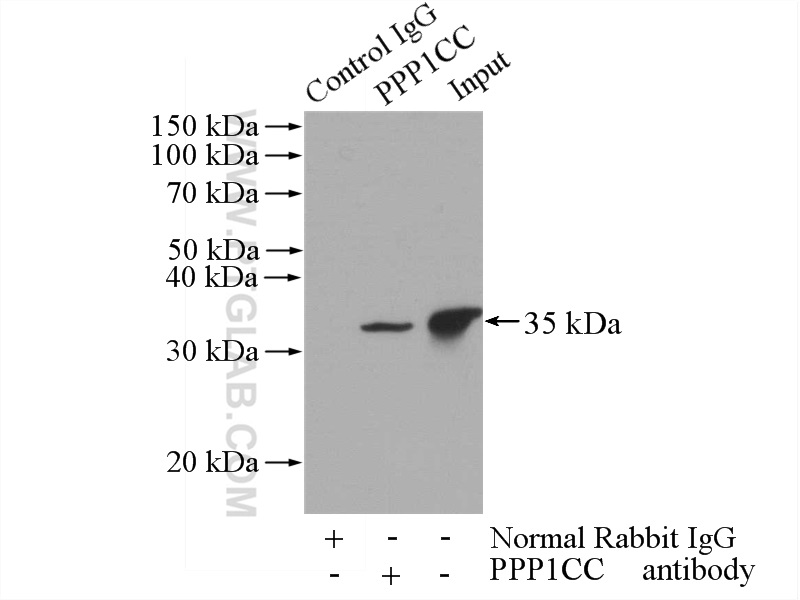 IP experiment of mouse brain using 55150-1-AP