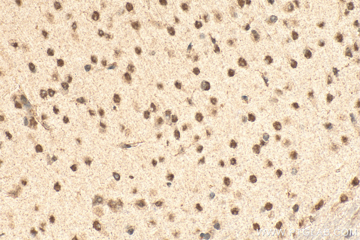 IHC staining of mouse brain using 24450-1-AP