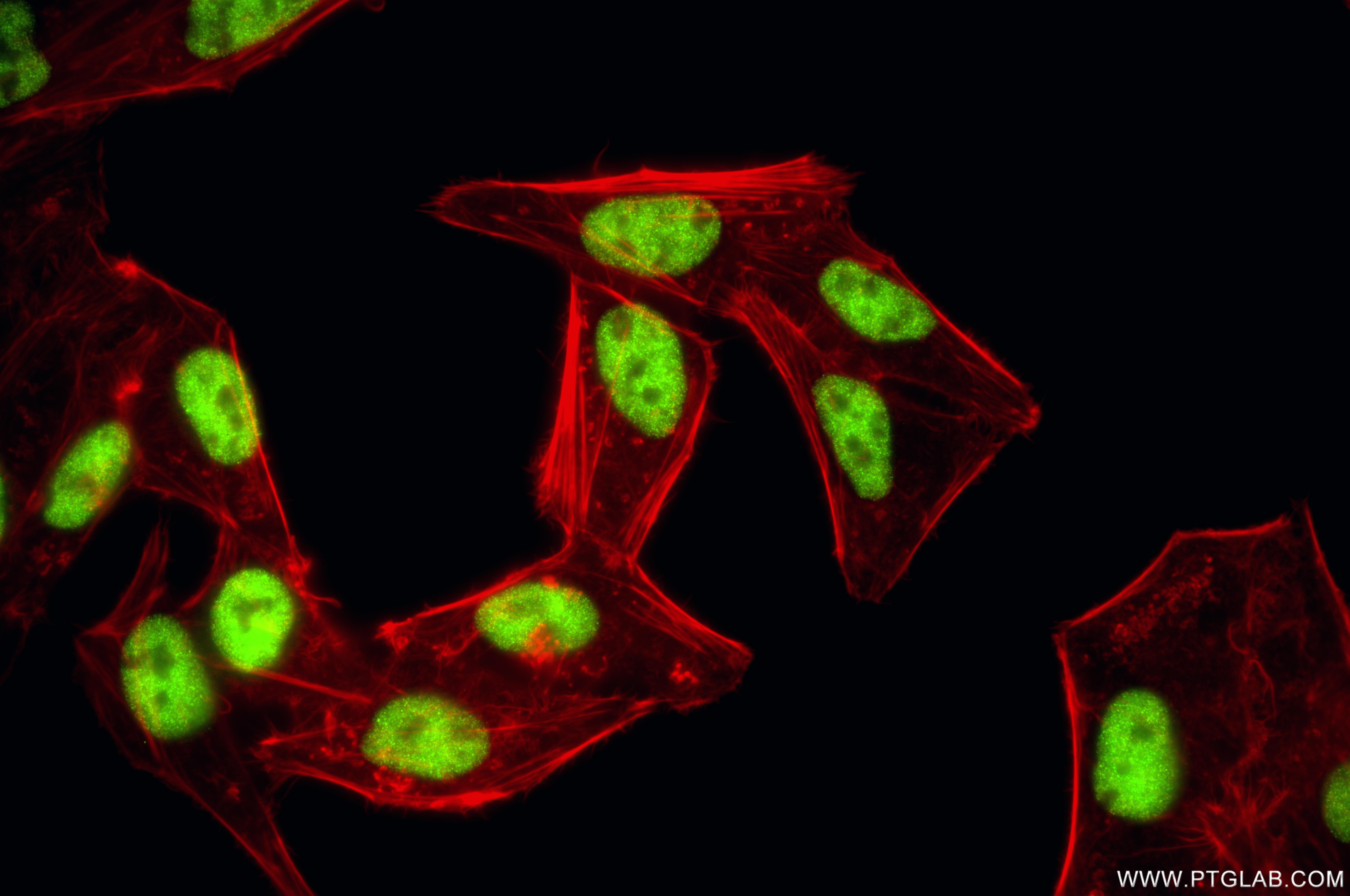 IF Staining of HepG2 using 86888-1-RR (same clone as 86888-1-PBS)