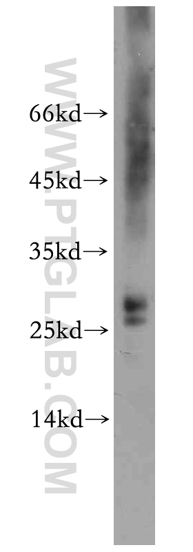 PPP1R11-Specific