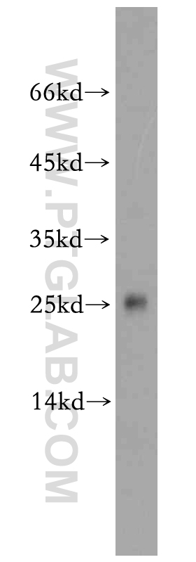 WB analysis of HeLa using 20263-1-AP