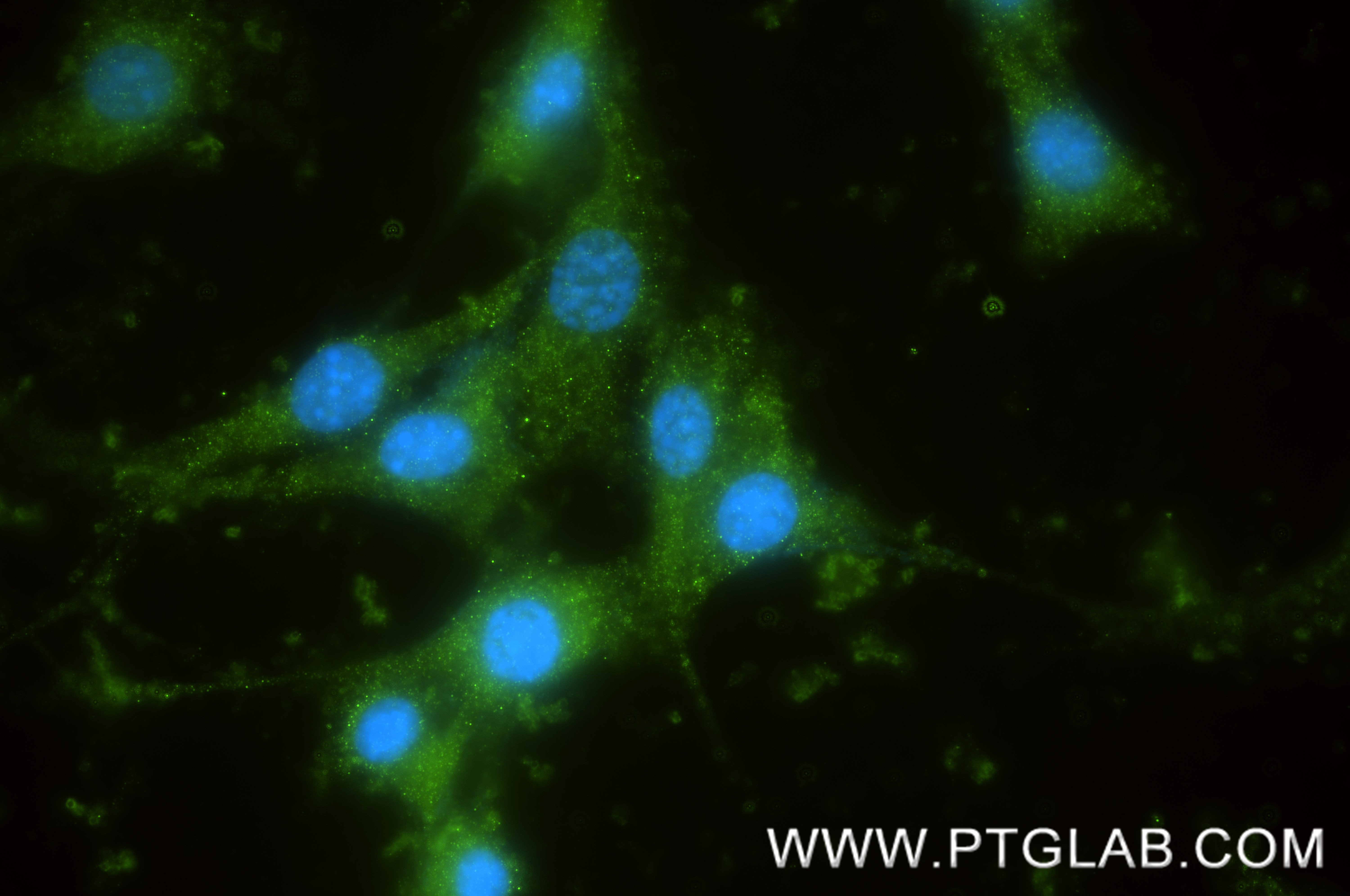 IF Staining of NIH/3T3 using 87808-1-RR IF Staining of NIH/3T3 using 87808-1-RR