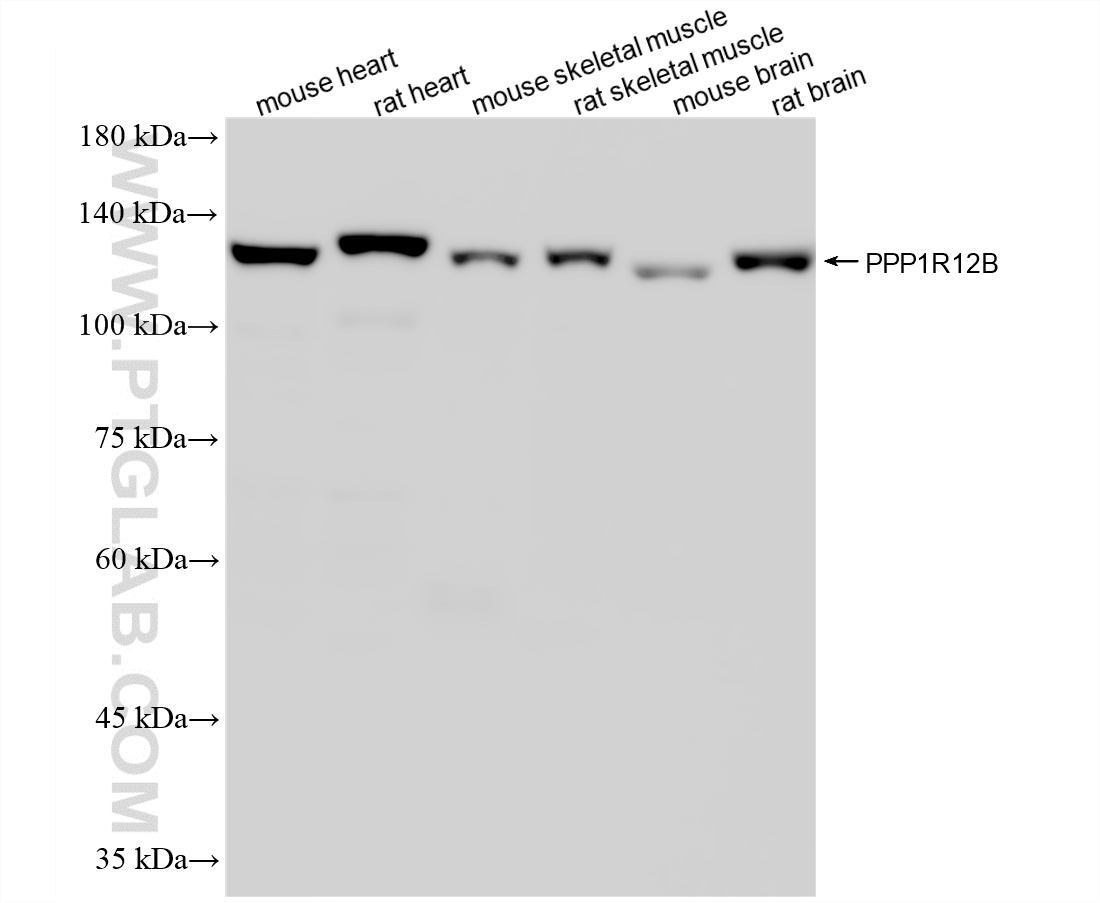 WB analysis using 87808-1-RR WB analysis using 87808-1-RR