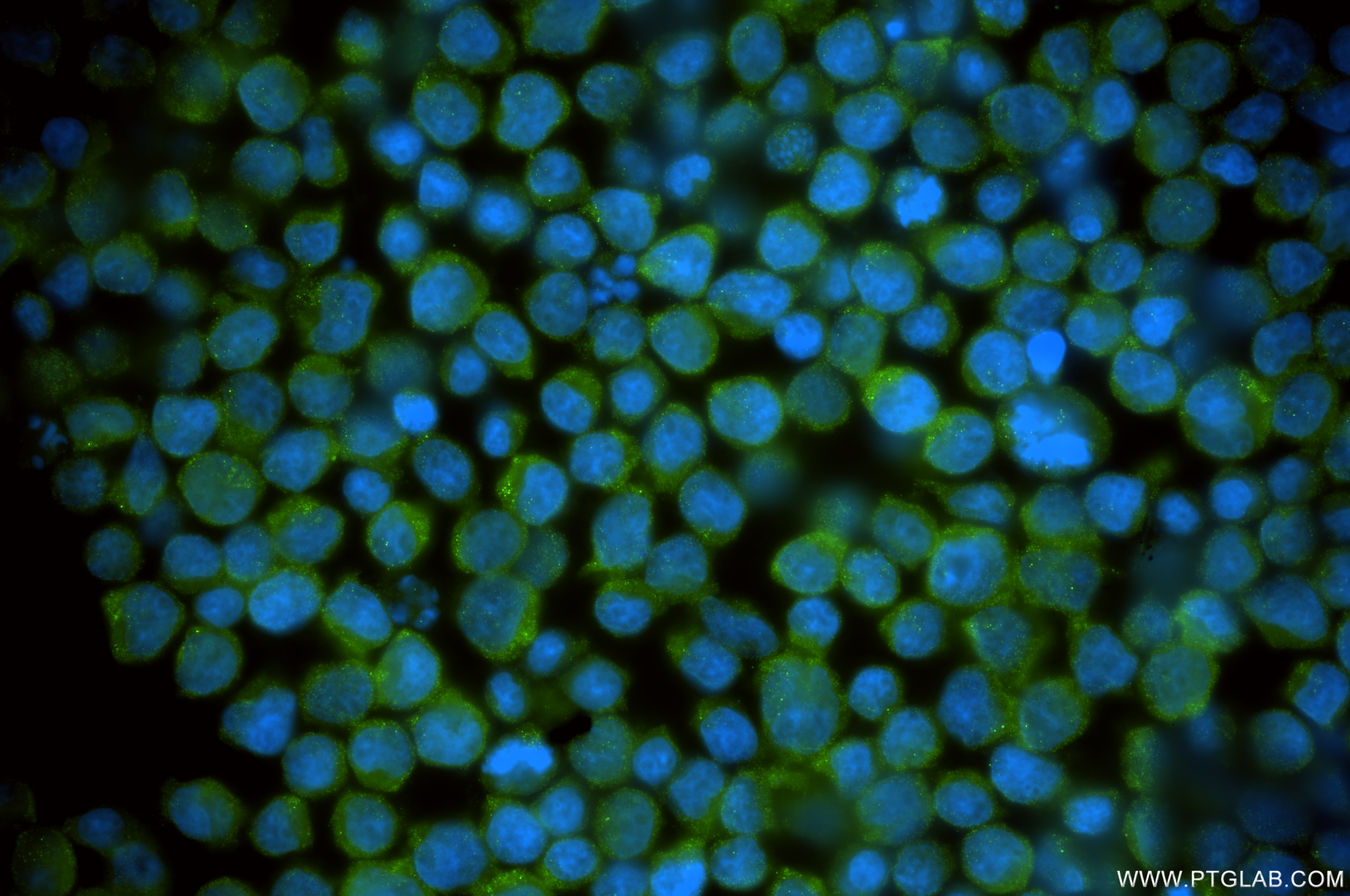 IF Staining of Jurkat using 86583-1-RR