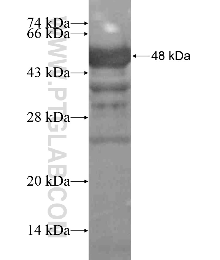 PPP1R12C fusion protein Ag18558 SDS-PAGE PPP1R12C fusion protein Ag18558 SDS-PAGE
