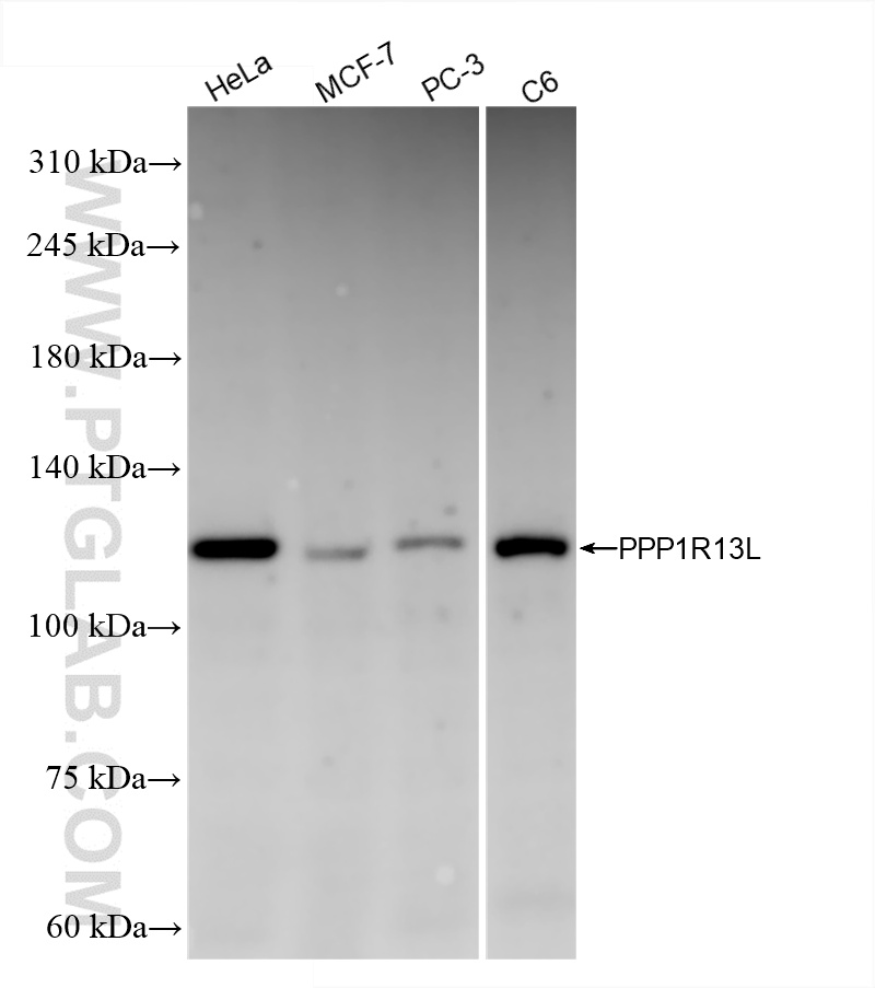 WB analysis using 86044-1-RR