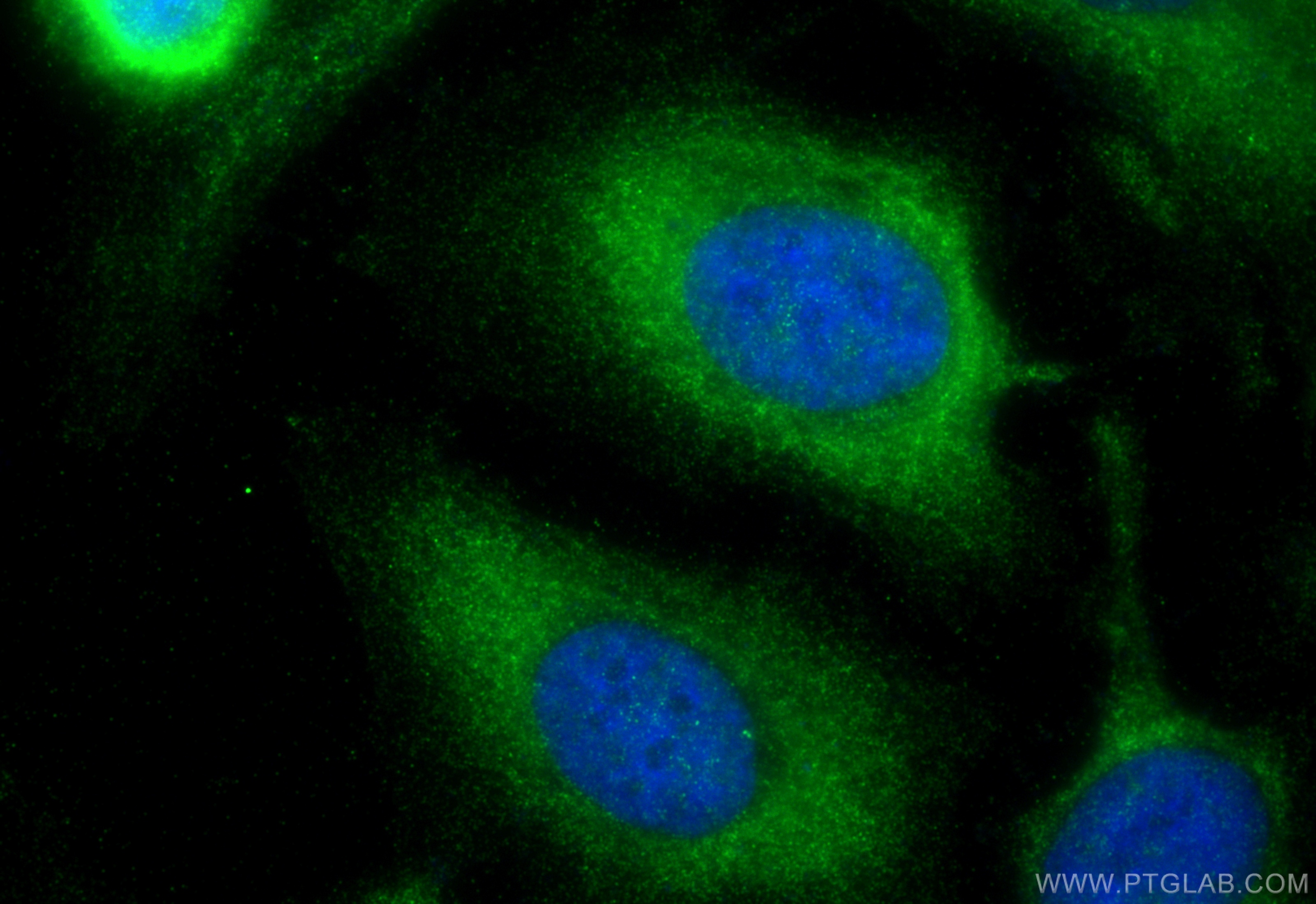 IF Staining of HeLa using 18476-1-AP