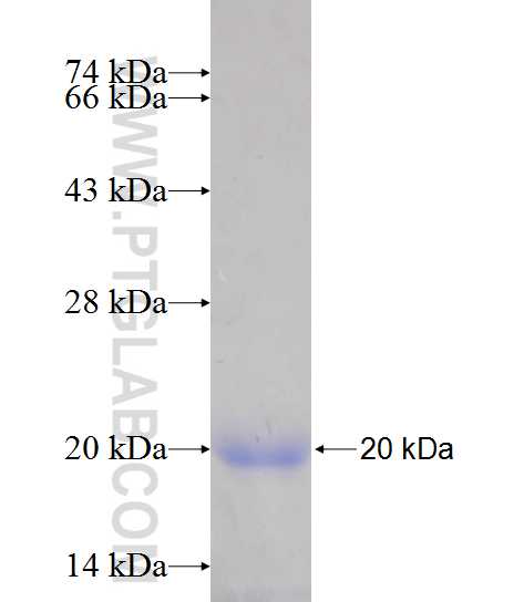 PPP1R14B fusion protein Ag13431 SDS-PAGE PPP1R14B fusion protein Ag13431 SDS-PAGE