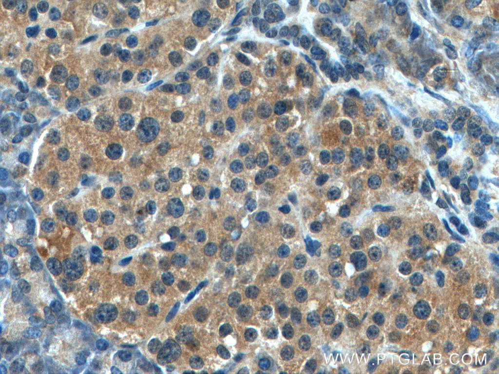 IHC staining of human pancreas using 10449-1-AP