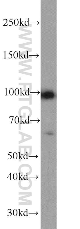 GADD34 Polyclonal antibody