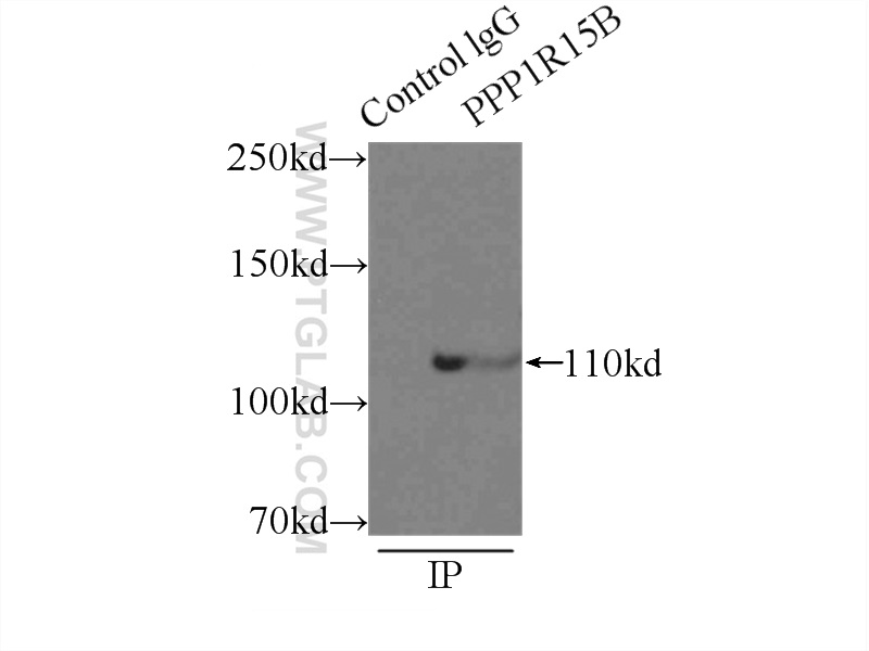 IP experiment of MCF-7 using 14634-1-AP