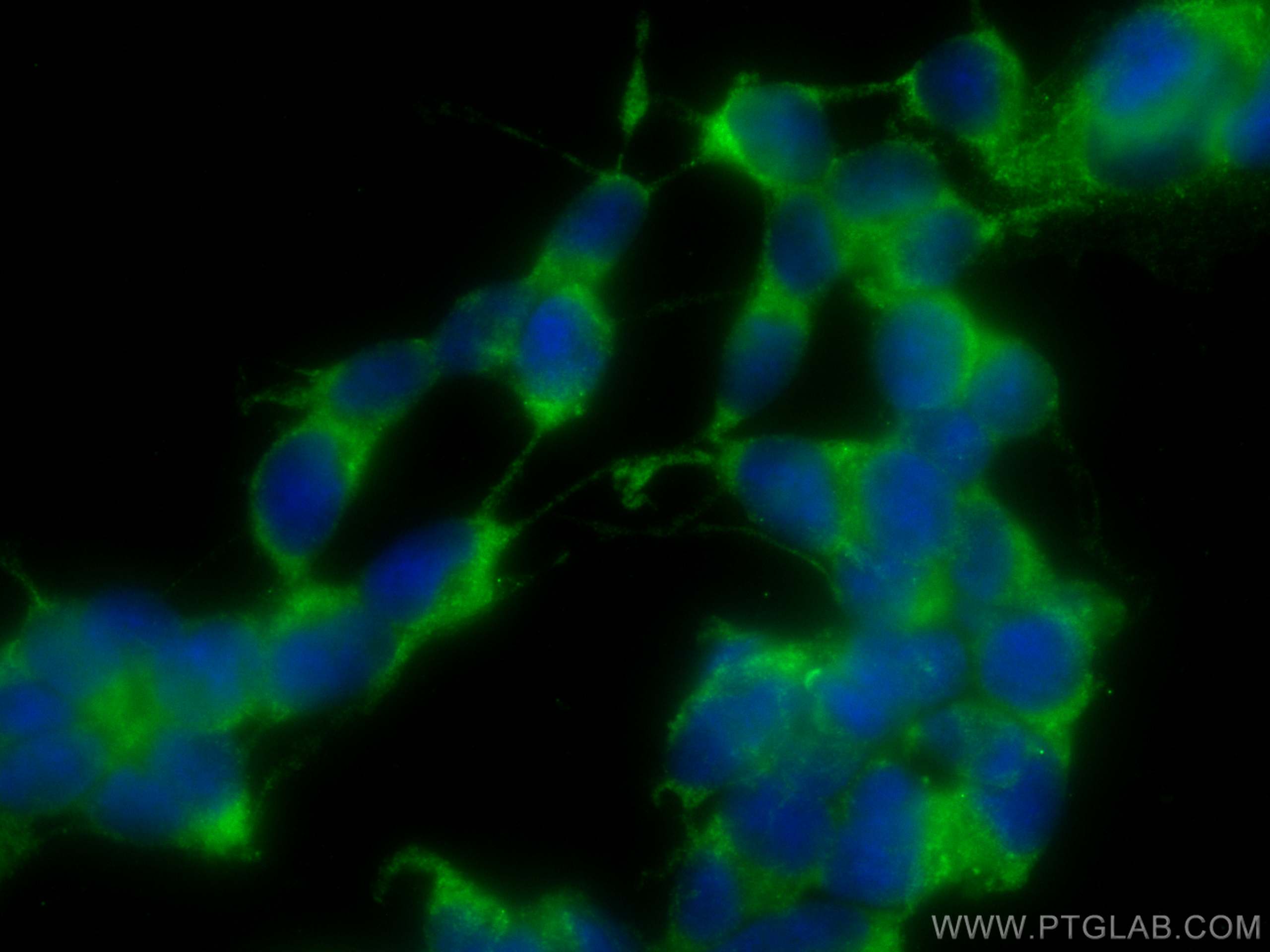 IF Staining of SH-SY5Y using CL488-14634