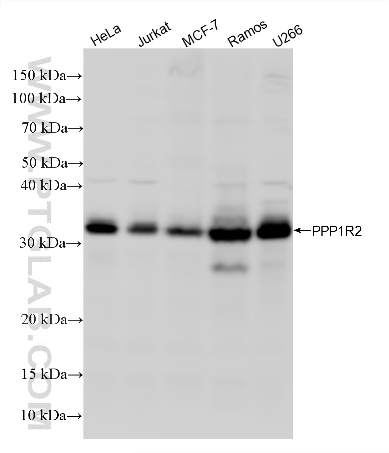 WB analysis using 87916-1-RR WB analysis using 87916-1-RR