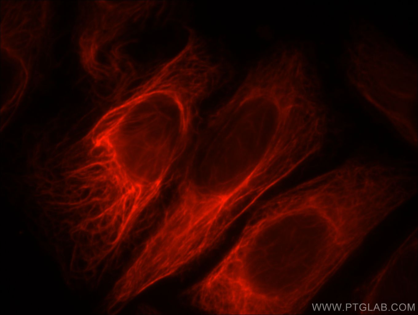 IF Staining of HepG2 using 11969-1-AP