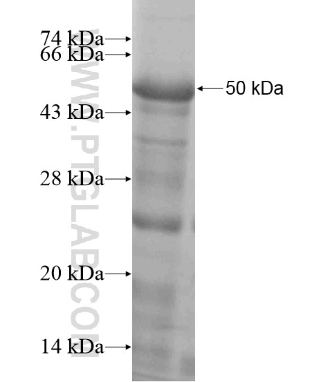 PPP1R3A fusion protein Ag19185 SDS-PAGE PPP1R3A fusion protein Ag19185 SDS-PAGE