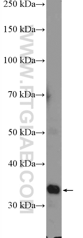 WB analysis of mouse liver using 14190-1-AP