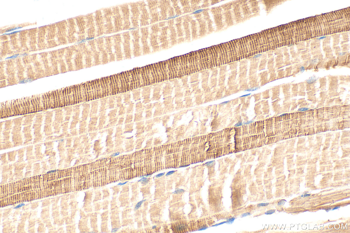 IHC staining of mouse skeletal muscle using 27285-1-AP