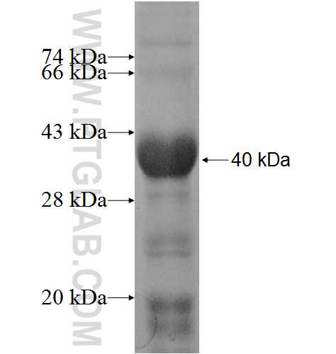 PPP1R3C fusion protein Ag8985 SDS-PAGE