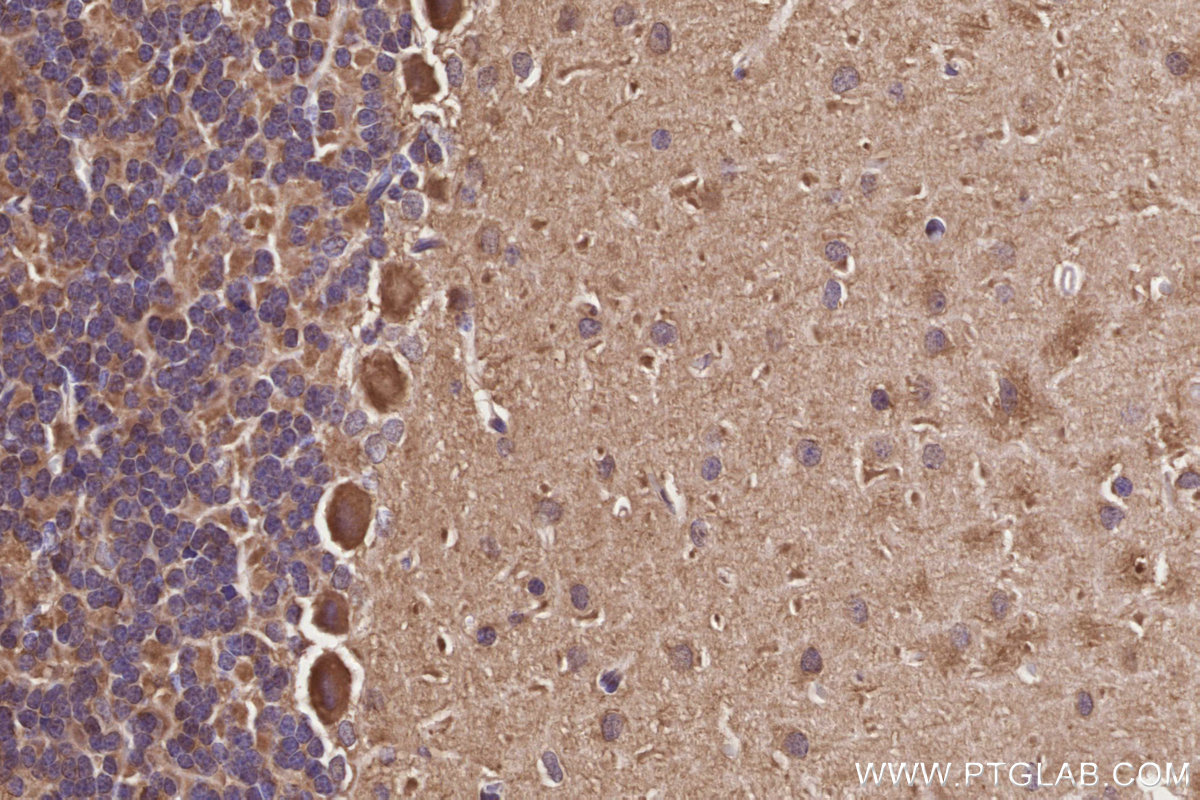 IHC staining of rat cerebellum using 55129-1-AP IHC staining of rat cerebellum using 55129-1-AP