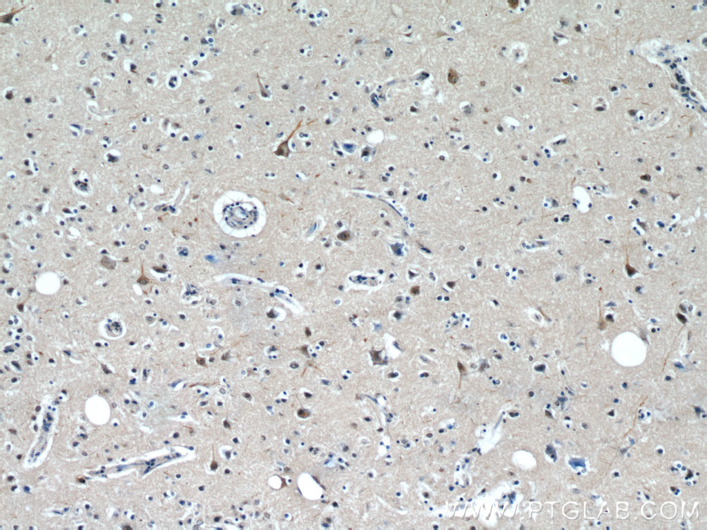 IHC staining of human brain using 55129-1-AP