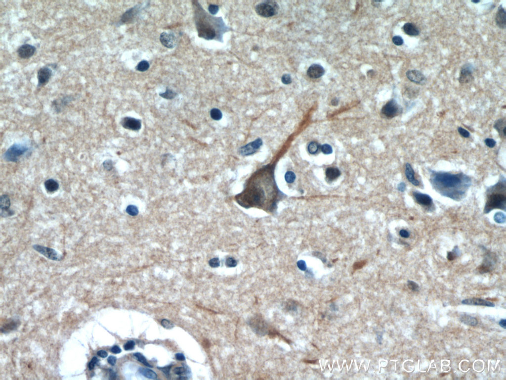 IHC staining of human brain using 55129-1-AP