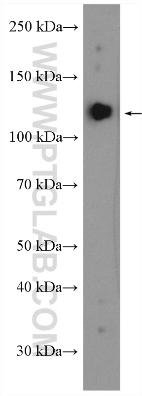 WB analysis of mouse brain using 55129-1-AP