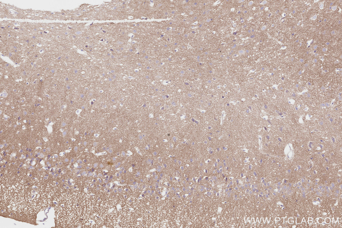 IHC staining of mouse brain using 85198-1-RR