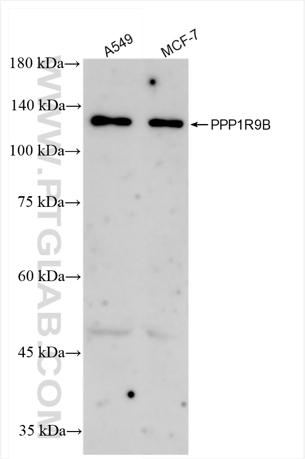 WB analysis using 85198-1-RR