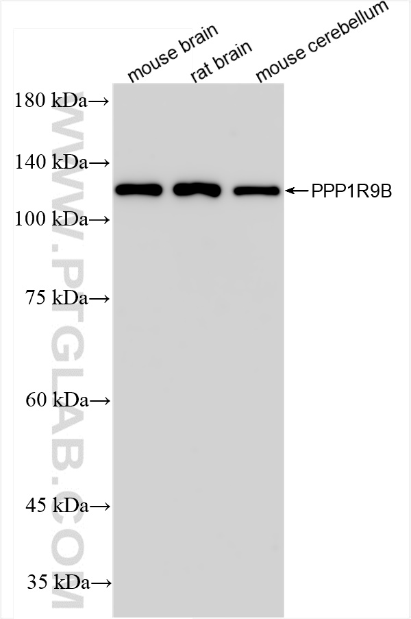 WB analysis using 85198-1-RR