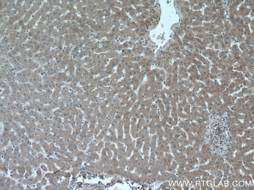 IHC staining of human liver using 13482-1-AP