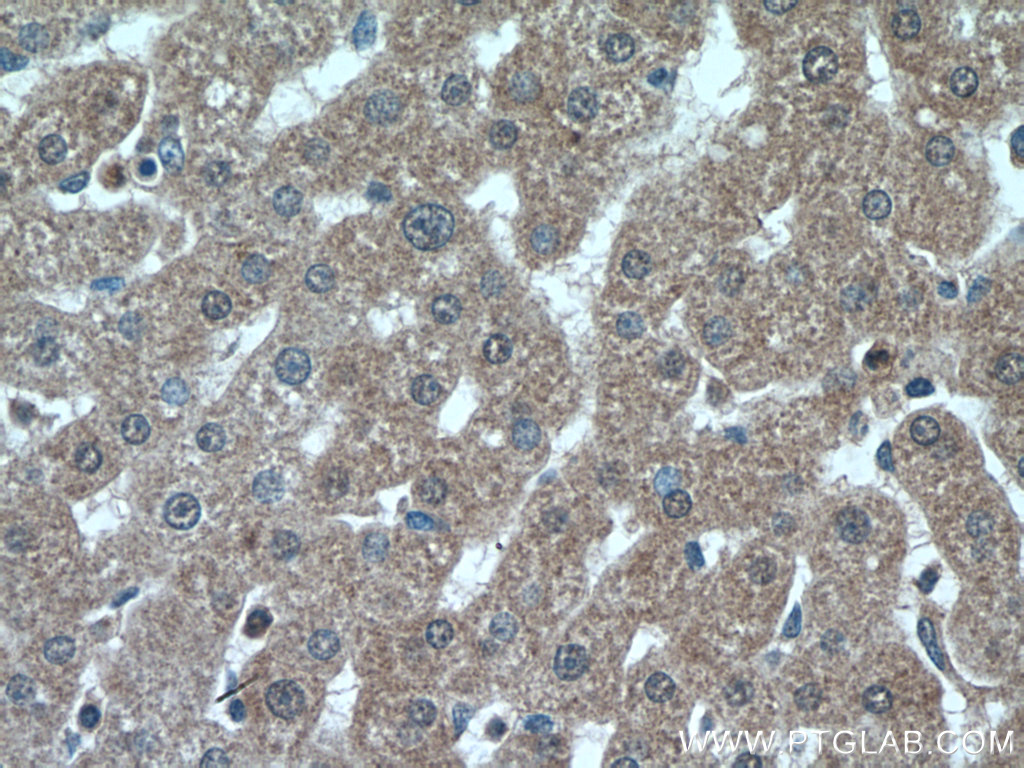 IHC staining of human liver using 13482-1-AP