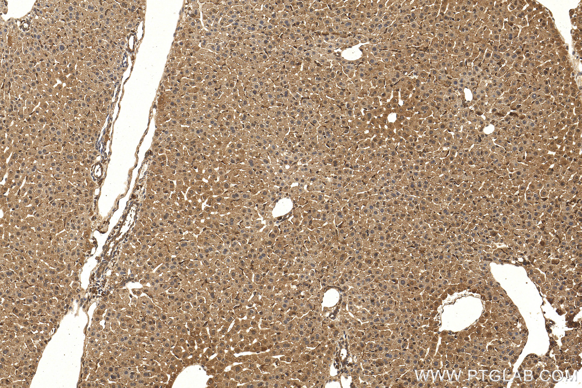 IHC staining of mouse liver using 13482-1-AP (same clone as 13482-1-PBS)