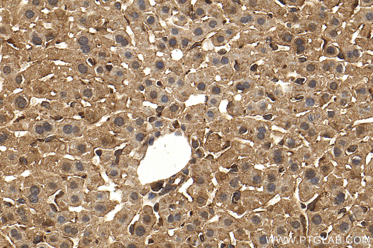 IHC staining of mouse liver using 13482-1-AP (same clone as 13482-1-PBS)