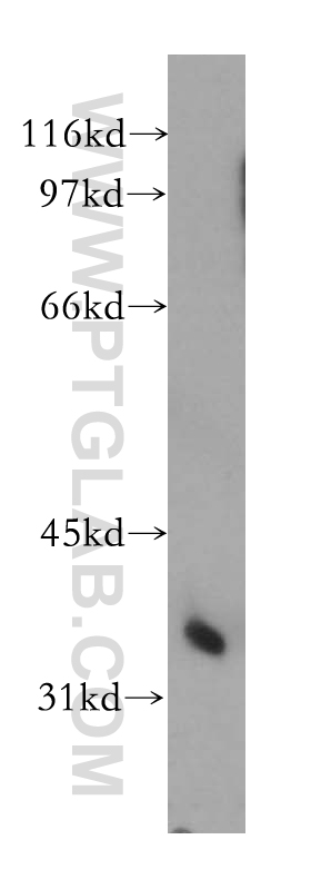 PPP2CA Polyclonal antibody