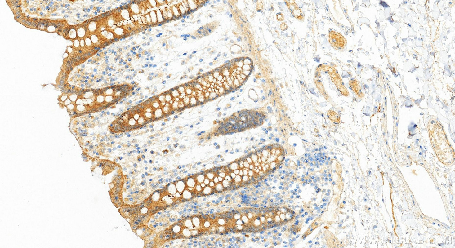 IHC staining of human colon using 84155-2-RR