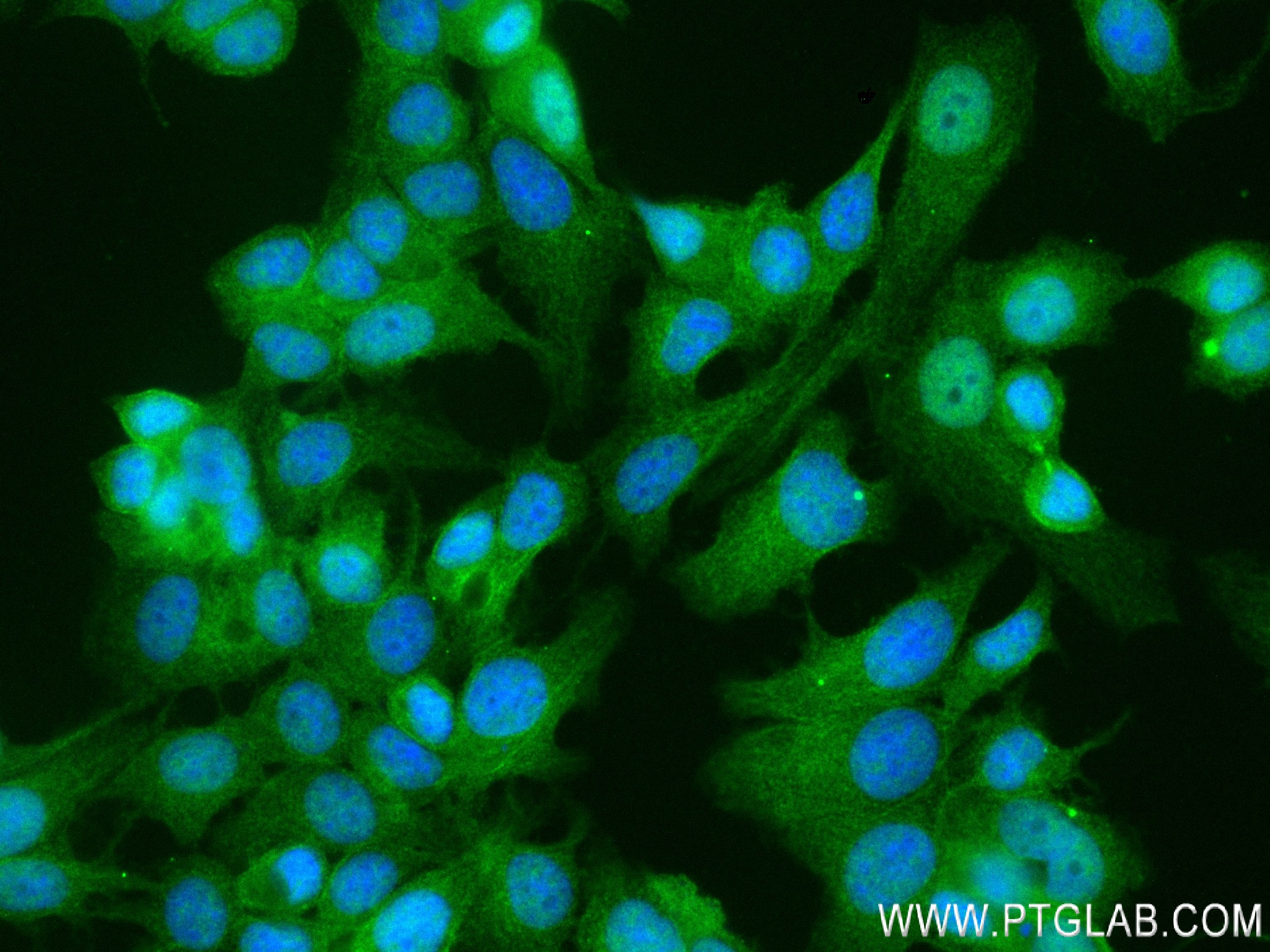 IF Staining of MCF-7 using 84155-6-RR (same clone as 84155-6-PBS)