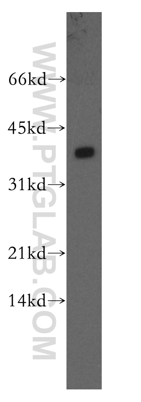 WB analysis of mouse lung using 12554-2-AP