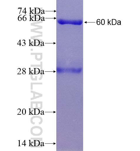 PPP2R1A fusion protein Ag8661 SDS-PAGE
