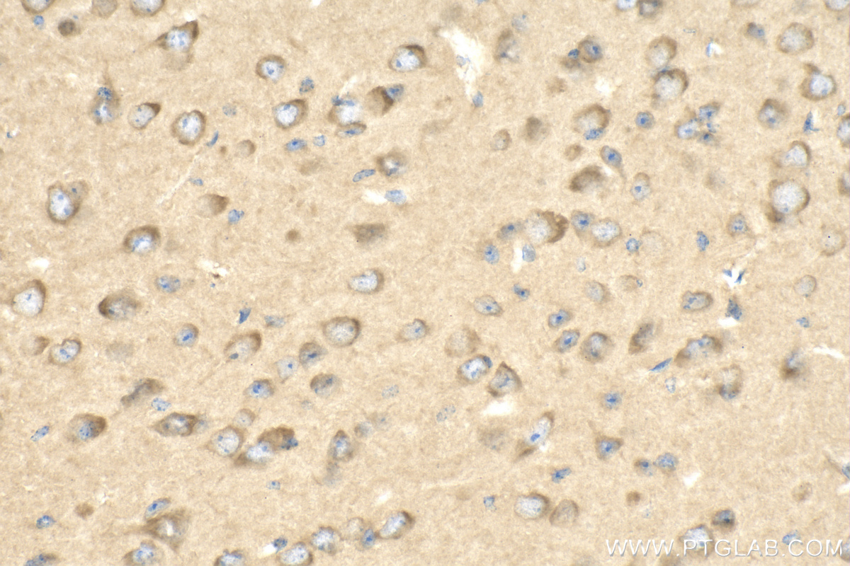 IHC staining of mouse brain using 16569-1-AP