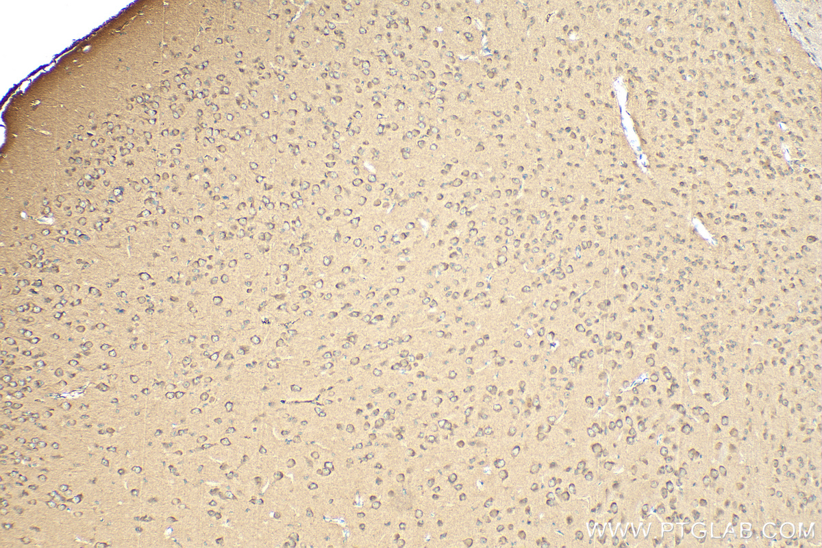 IHC staining of mouse brain using 16569-1-AP