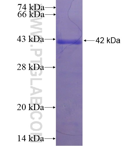 PPP2R2A fusion protein Ag10072 SDS-PAGE