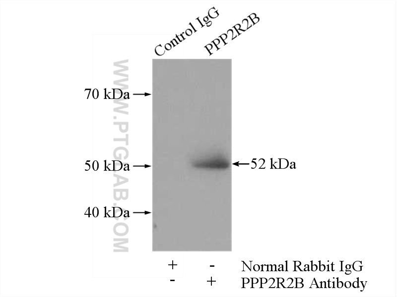 IP experiment of SH-SY5Y using 13123-1-AP