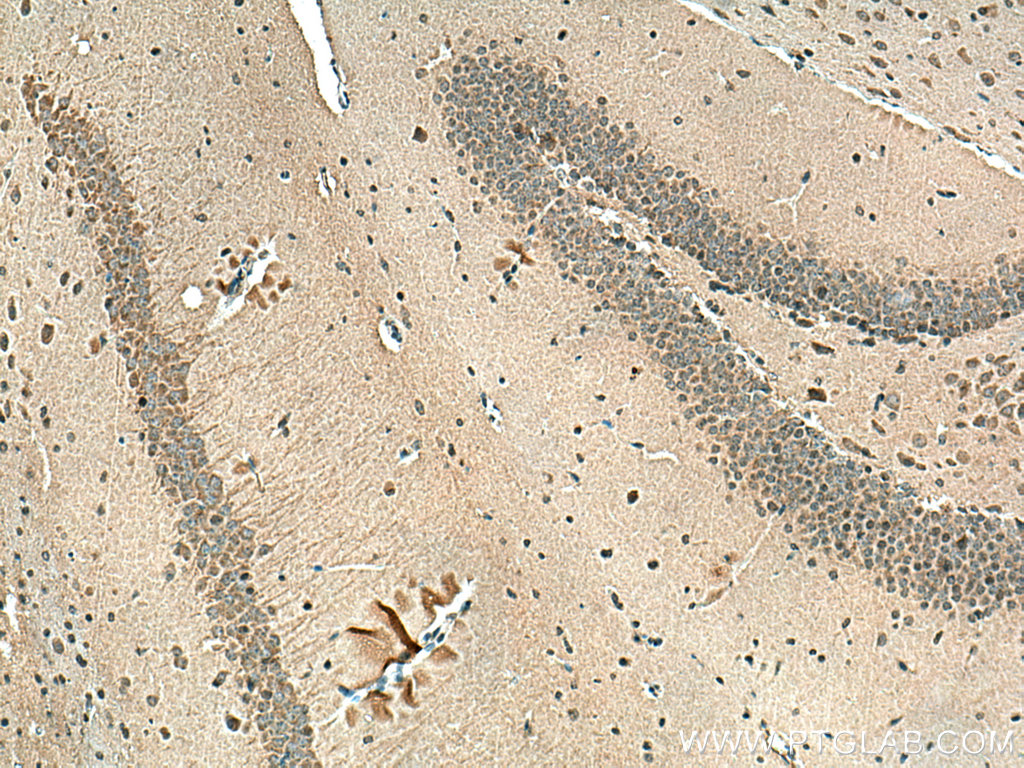 IHC staining of mouse brain using 67783-1-Ig (same clone as 67783-1-PBS)