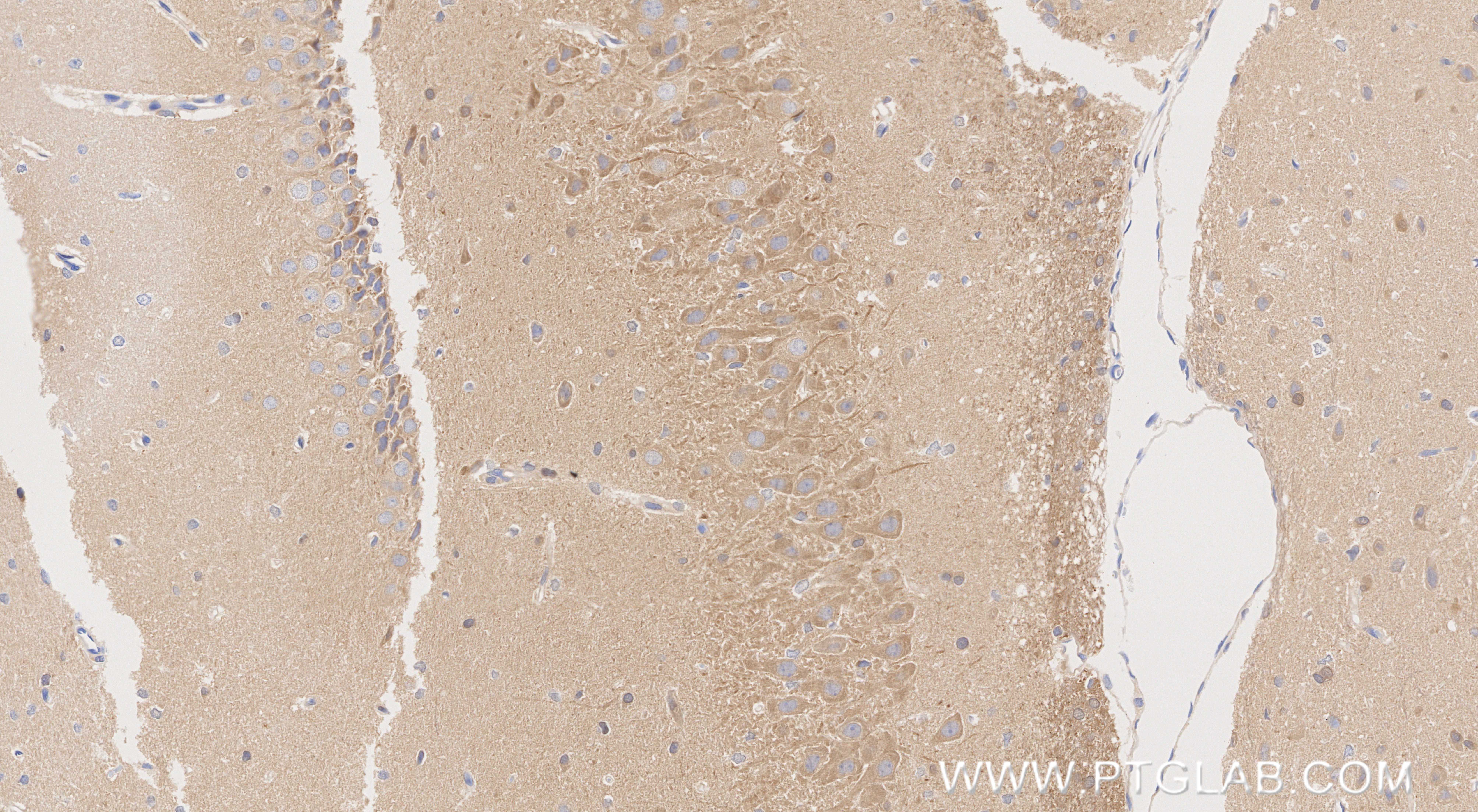 IHC staining of rat brain using 86383-1-RR