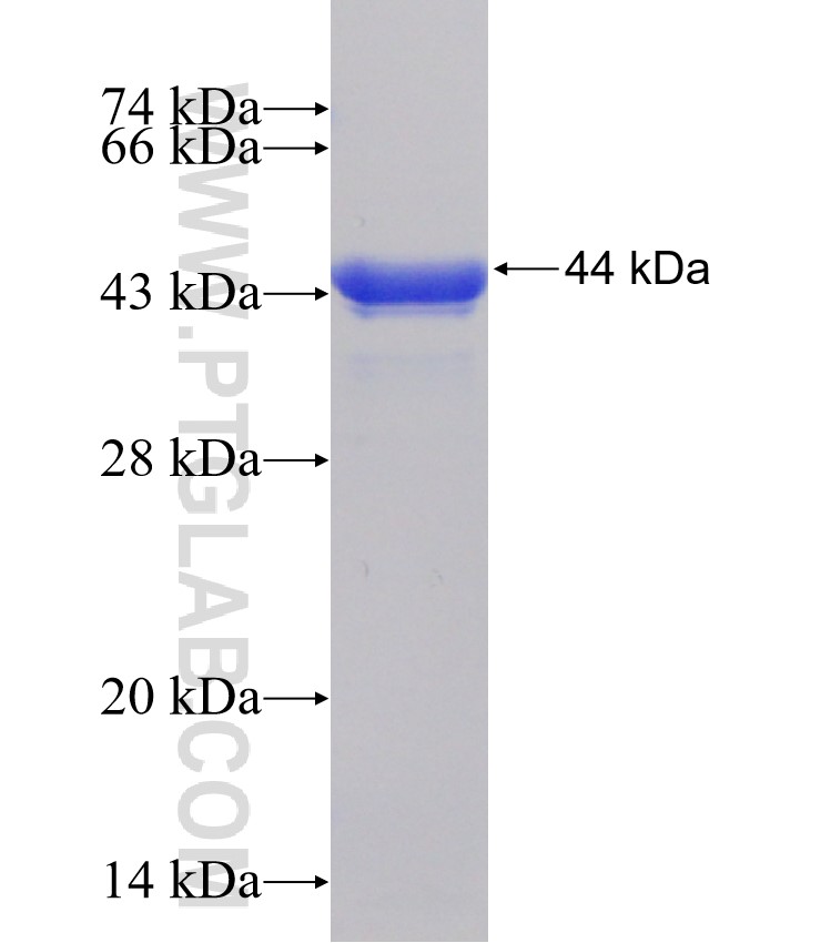 PPP2R3A fusion protein Ag31511 SDS-PAGE