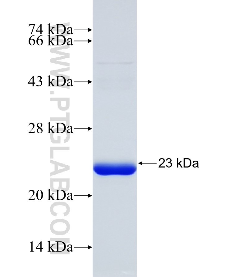 PPP2R3A fusion protein Ag31522 SDS-PAGE