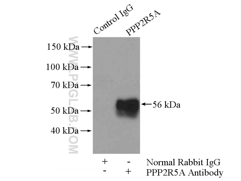IP experiment of mouse brain using 12675-2-AP (same clone as 12675-2-PBS)