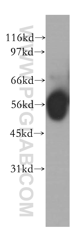 WB analysis of human ileum using 12675-2-AP