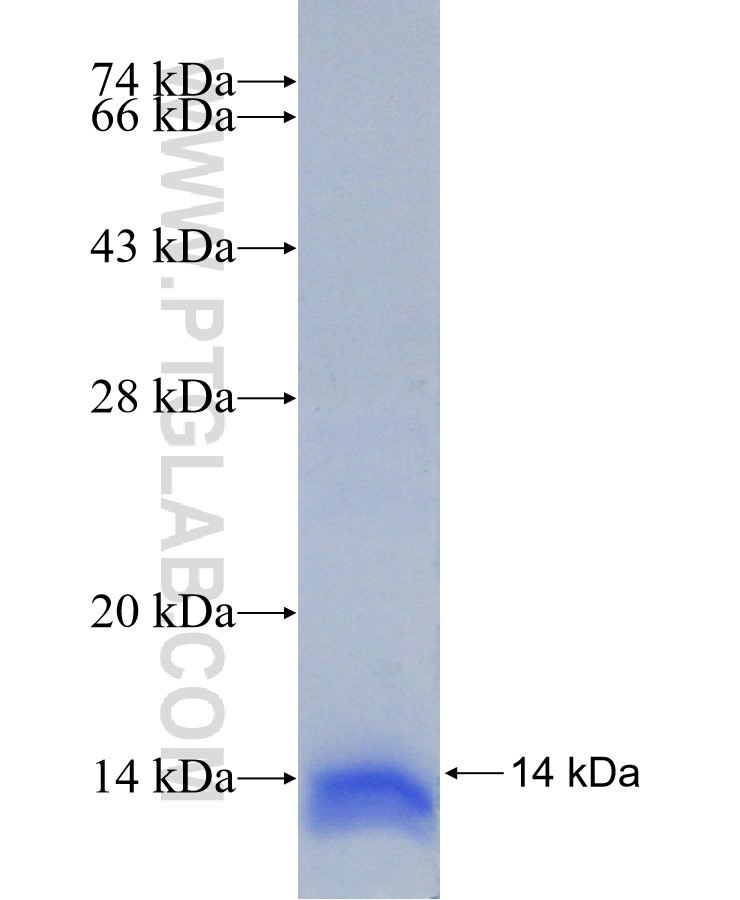 PPP2R5A fusion protein Ag31150 SDS-PAGE PPP2R5A fusion protein Ag31150 SDS-PAGE