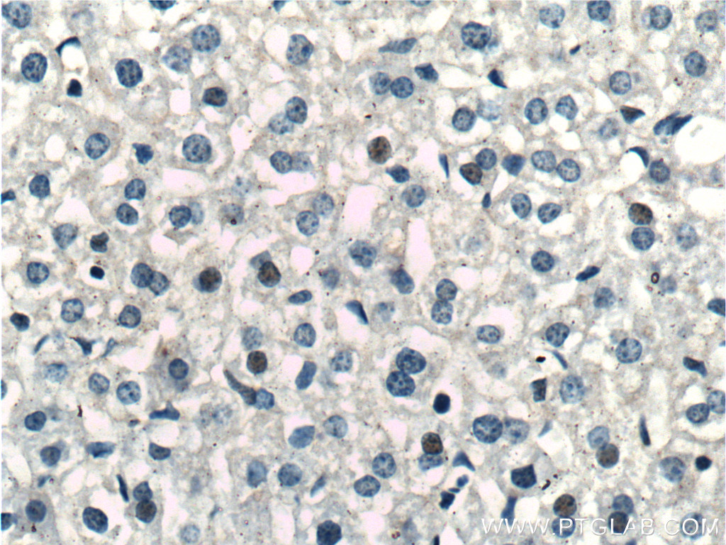 IHC staining of mouse liver using 11276-1-AP